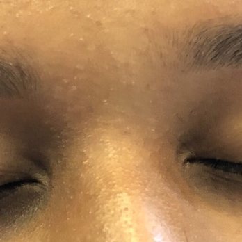 Esthetics Juli - Final look after touch up - Skin Care Near Me - Herndon, Virginia