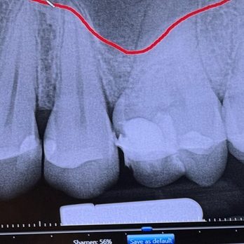 X Dentistry - General Dentistry Near Me - Tijuana, BCN