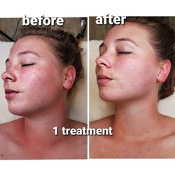 Sculptiko Beauty - My before and after photos!