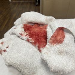 Childrens Dental Surgery Center - Visalia - These pictures don't do justice to the amount of blood there was , she had blood dripping down her chest !