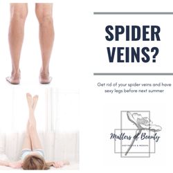 Matters Of Beauty - Easy treatment of unsightly spider veins using sclerotherapy.