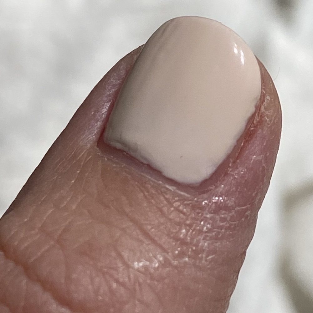 dehydrated my Skin and nails. Excess Acetone should be squeezed out of cotton ball so its not dripping down my fingers. dehydrated my Skin and nails. Excess Acetone should be squeezed out of cotton ball so its not dripping down my fingers.