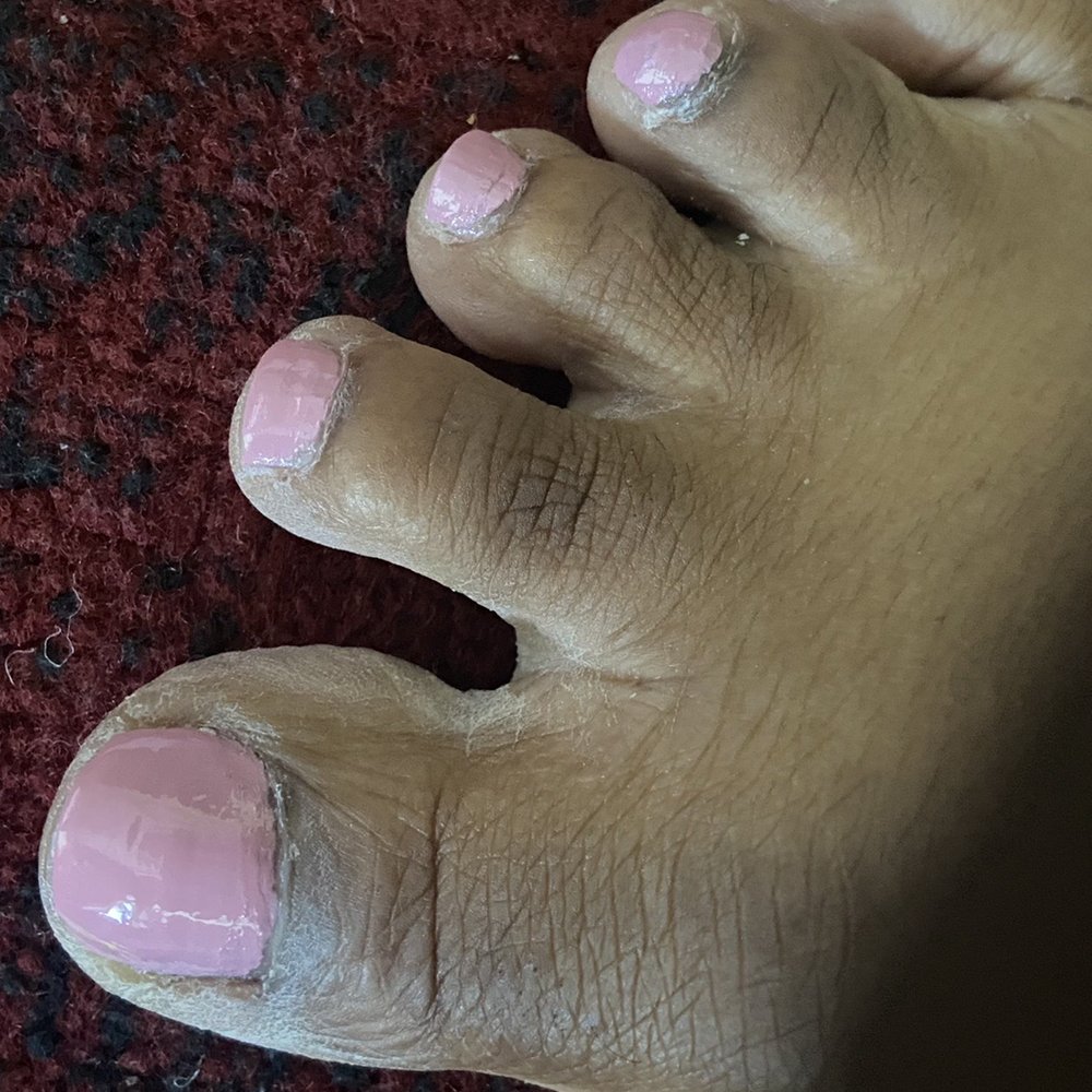 OMG My Nails - The polish is botched! The dryness around the toes and the web of the toes. I had to ask her to go over the cuticles again. - Nail Salons Near Me - Fairfax, Virginia OMG My Nails - The polish is botched! The dryness around the toes and the web of the toes. I had to ask her to go over the cuticles again. - Nail Salons Near Me - Fairfax, Virginia