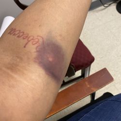 MUSC Health - This should not be the outcome when someone sticks you just horrible