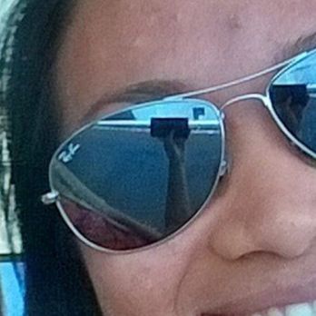 Skin Spa by Susi Go - Before. Even with foundation and make up you can see the acne.. - Estheticians Near Me - Lake Forest, California