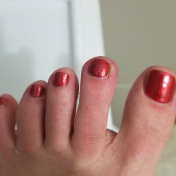 Q Spa - Infected second toe after my nail tech was painfully aggressive with my cuticles and cut the skin. - Skin Care Near Me - San Francisco, California