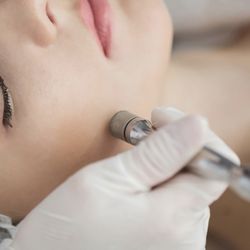 Aelita's beauty services - Microdermabrasion facial