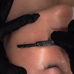 Glow & Tell Aesthetics - Dermaplaning