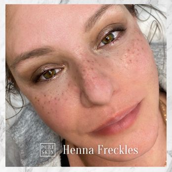 Pure Skin Permanent Cosmetics - Henna Freckles - Permanent Makeup Near Me - Maynard, Massachusetts Pure Skin Permanent Cosmetics - Henna Freckles - Permanent Makeup Near Me - Maynard, Massachusetts
