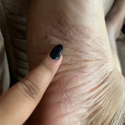 Q Nails & Spa - Cuts on my foot that were not there when I went to the salon.