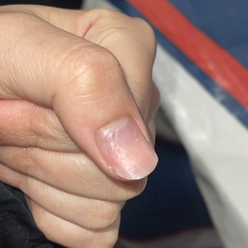 Anni's Nails - damage done to my nails. from drilling at an angle. - Nail Salons Near Me - San Jose, California