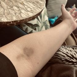 Scripps Coastal Medical Center Hillcrest - Terrible blood work- no compassion- they don't even know who you are bc they don't read charts.