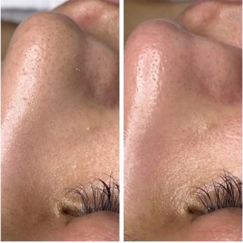 Sessions with Loana - Skin Care Near Me - Wildomar, California