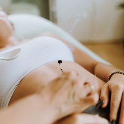 Erin Heidrich Acupuncture