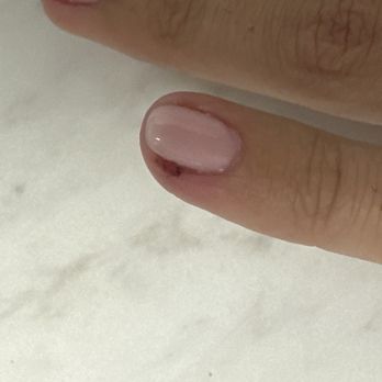 Polish Nail Spa - Hurt nail - Nail Salons Near Me - Lake Forest, California Polish Nail Spa - Hurt nail - Nail Salons Near Me - Lake Forest, California