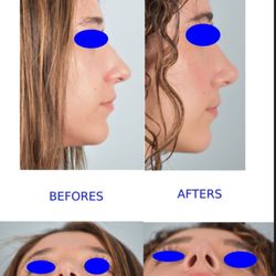 Jennifer Goodrich, M.D - Metro ENT & Facial Plastic Surgery