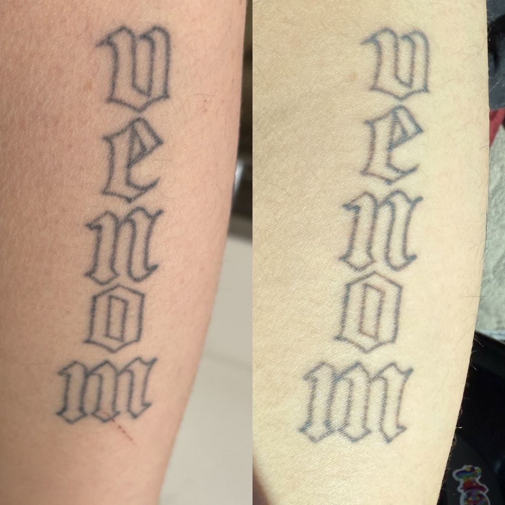 New Skin Tattoo Removal - social services organization in Concord, CA