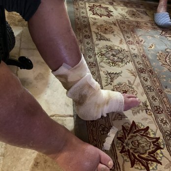 Visiting Nurse Health System - December 9 photo of my dad's leg with a nurse and wrapped it. He now has to go to a doctor to check for infection. - Home Health Care Near Me - Atlanta, Georgia Visiting Nurse Health System - December 9 photo of my dad's leg with a nurse and wrapped it. He now has to go to a doctor to check for infection. - Home Health Care Near Me - Atlanta, Georgia
