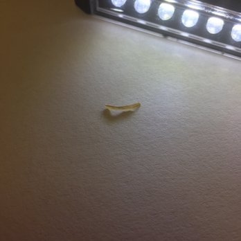 China 1 - Finger nail in my egg roll. - Chinese Near Me - Mount Clemens, Michigan