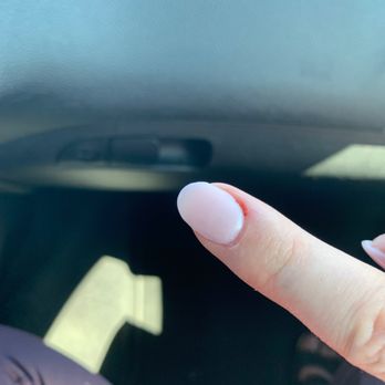 D'lux Nails & Spa - Bleeding finger - Nail Salons Near Me - Aurora, Colorado