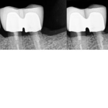 Berkeley Hills Dental Care - General Dentistry Near Me - Berkeley, California Berkeley Hills Dental Care - General Dentistry Near Me - Berkeley, California