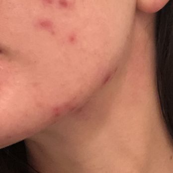 Paul Labrecque Salon & Spa - I came in with 95% clear skin and left looking like the before picture of a proactive ad. Wouldn't recommend to an arch enemy. - Hair Salons Near Me - New York, New York