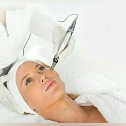 Microneedling