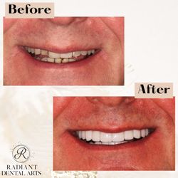 Radiant Dental Arts - Check out this smile makeover!
Call to schedule a consultation today!
