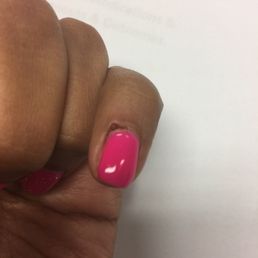 Part of cuticle taking off