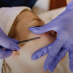 My Esthetician - Dermaplaning