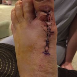 Foot & Ankle Surgical Associates