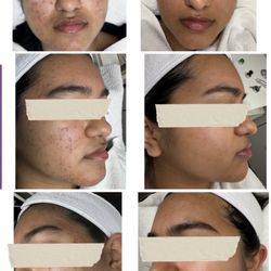 Unblemished Skin Studio
