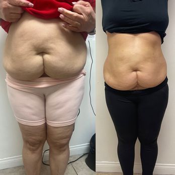 Embodyment - Weight Loss Centers Near Me - Redondo Beach, California Embodyment - Weight Loss Centers Near Me - Redondo Beach, California