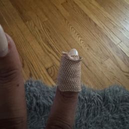 Broken nail it broke along my finger it was bleeding pretty bad also sidenote these are my real nails Broken nail it broke along my finger it was bleeding pretty bad also sidenote these are my real nails