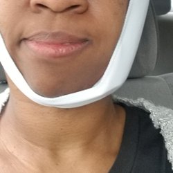 Chevy Chase Implant and Oral Surgery - My mouth after the extraction