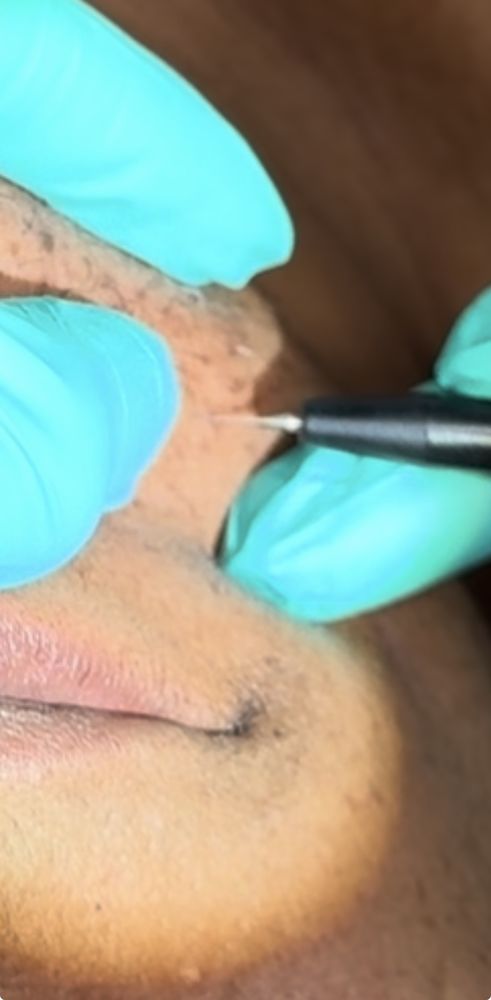 Blush Electrolysis & Skin Care Logo