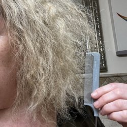 My hair used to go down pass my shoulders. Now it is to my neck level. I can barely put it up in a pony tail. I lost density as well.