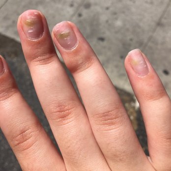 Bella Nails & Spa - This is what happens when you don't bond nails properly fungus on all four nails - Nail Salons Near Me - Oxnard, California