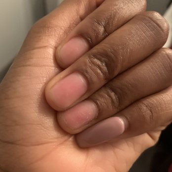 Pink Toes - First set all off after 6-9 days. - Nail Salons Near Me - Sunnyside, New York Pink Toes - First set all off after 6-9 days. - Nail Salons Near Me - Sunnyside, New York