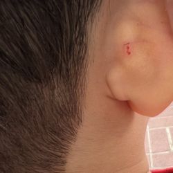 Cookie Cutters Haircuts for Kids - The nick on his ear