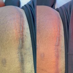 Stacey Carta Skin Care - Scar release therapy.