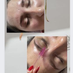 SB Skincentives