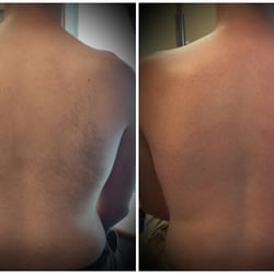 Back Wax - Before and After - Courtesy of Nathan N.