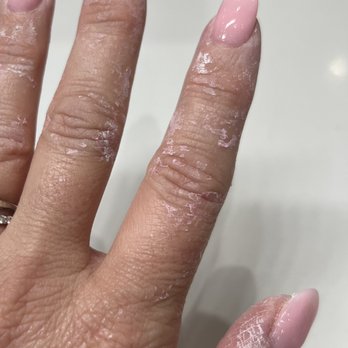 Luxe Nails Lounge - Sticky residue from dip left on hands.  I had to go to another establishment to have removed. - Nail Salons Near Me - San Antonio, Texas