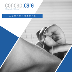 Concept Care Chiropractic and Wellness Center - Acupuncture