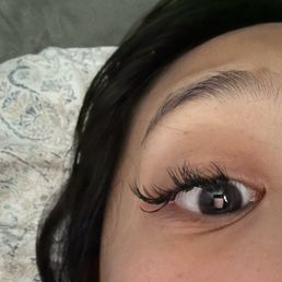 After 5 days After 5 days