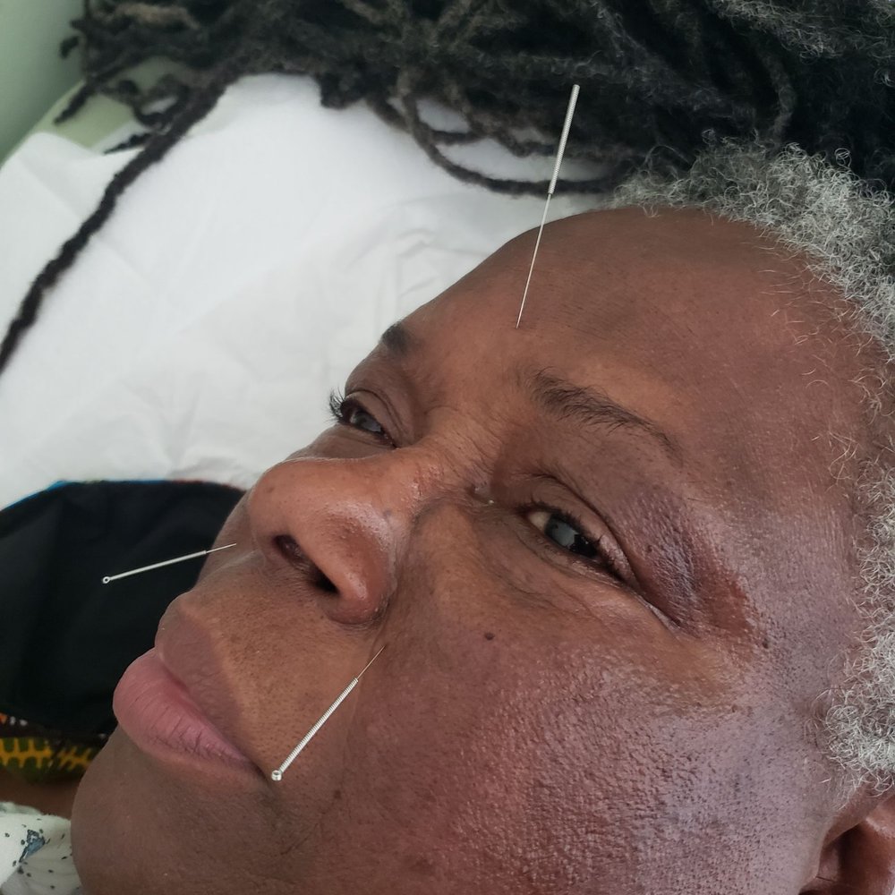 weMED Health - Acupuncture - Acupuncture Near Me - Houston, Texas