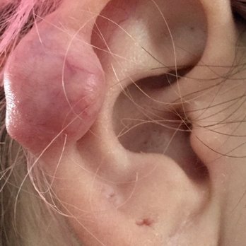 World Class Tattooing Studios - Another angle of what my ear now looks like after an industrial piercing done by Will at World Class Tattoo. - Piercing Near Me - Berwyn, Illinois