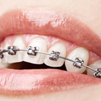 Rice Orthodontics - Orthodontists Near Me - Paducah, Kentucky Rice Orthodontics - Orthodontists Near Me - Paducah, Kentucky