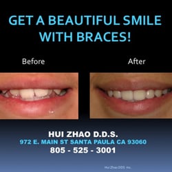 Hui Zhao, DDS